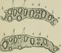 An illustration from Atlas and text-book of dentistry including diseases of the mouth / by Gustav Preiswerk. Edited by George W. Warren. (1906)