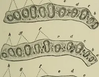 An illustration from Atlas and text-book of dentistry including diseases of the mouth / by Gustav Preiswerk. Edited by George W. Warren. (1906)