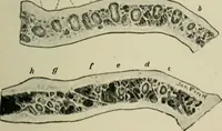 An illustration from Atlas and text-book of dentistry including diseases of the mouth / by Gustav Preiswerk. Edited by George W. Warren. (1906)