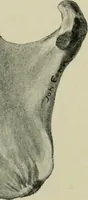 An illustration from Atlas and text-book of dentistry including diseases of the mouth / by Gustav Preiswerk. Edited by George W. Warren. (1906)