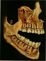 An illustration from Atlas and text-book of dentistry including diseases of the mouth / by Gustav Preiswerk. Edited by George W. Warren. (1906)