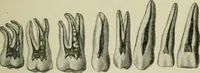 An illustration from Atlas and text-book of dentistry including diseases of the mouth / by Gustav Preiswerk. Edited by George W. Warren. (1906)