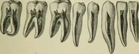 An illustration from Atlas and text-book of dentistry including diseases of the mouth / by Gustav Preiswerk. Edited by George W. Warren. (1906)