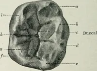 An illustration from Atlas and text-book of dentistry including diseases of the mouth / by Gustav Preiswerk. Edited by George W. Warren. (1906)