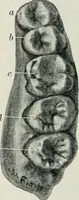 An illustration from Atlas and text-book of dentistry including diseases of the mouth / by Gustav Preiswerk. Edited by George W. Warren. (1906)