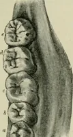 An illustration from Atlas and text-book of dentistry including diseases of the mouth / by Gustav Preiswerk. Edited by George W. Warren. (1906)