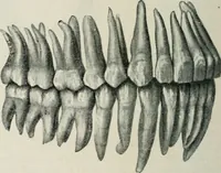 An illustration from Atlas and text-book of dentistry including diseases of the mouth / by Gustav Preiswerk. Edited by George W. Warren. (1906)