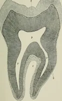 An illustration from Atlas and text-book of dentistry including diseases of the mouth / by Gustav Preiswerk. Edited by George W. Warren. (1906)