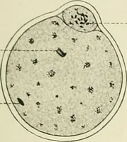 Picture 39 of 231 from Obstetrics : a text-book for the use of students and practitioners / by J. Whitridge Williams ... with eight coloured plates and six hundred and thirty illustrations in the text. (1903), leaf 117