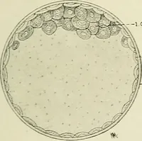 An illustration from Obstetrics : a text-book for the use of students and practitioners / by J. Whitridge Williams ... with eight coloured plates and six hundred and thirty illustrations in the text. (1903)