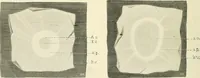 An illustration from Obstetrics : a text-book for the use of students and practitioners / by J. Whitridge Williams ... with eight coloured plates and six hundred and thirty illustrations in the text. (1903)