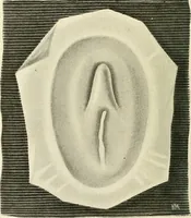 An illustration from Obstetrics : a text-book for the use of students and practitioners / by J. Whitridge Williams ... with eight coloured plates and six hundred and thirty illustrations in the text. (1903)
