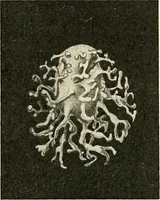 An illustration from Obstetrics : a text-book for the use of students and practitioners / by J. Whitridge Williams ... with eight coloured plates and six hundred and thirty illustrations in the text. (1903)
