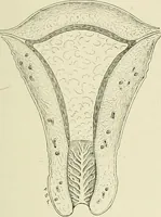 An illustration from Obstetrics : a text-book for the use of students and practitioners / by J. Whitridge Williams ... with eight coloured plates and six hundred and thirty illustrations in the text. (1903)