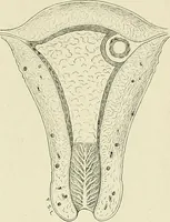 An illustration from Obstetrics : a text-book for the use of students and practitioners / by J. Whitridge Williams ... with eight coloured plates and six hundred and thirty illustrations in the text. (1903)