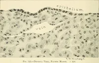 Picture 70 of 231 from Obstetrics : a text-book for the use of students and practitioners / by J. Whitridge Williams ... with eight coloured plates and six hundred and thirty illustrations in the text. (1903), leaf 142
