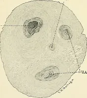 An illustration from Obstetrics : a text-book for the use of students and practitioners / by J. Whitridge Williams ... with eight coloured plates and six hundred and thirty illustrations in the text. (1903)