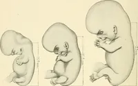 An illustration from Obstetrics : a text-book for the use of students and practitioners / by J. Whitridge Williams ... with eight coloured plates and six hundred and thirty illustrations in the text. (1903)