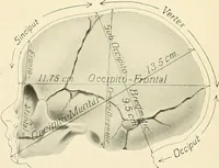 Picture 76 of 231 from Obstetrics : a text-book for the use of students and practitioners / by J. Whitridge Williams ... with eight coloured plates and six hundred and thirty illustrations in the text. (1903), leaf 174
