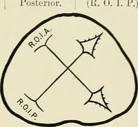 Picture 84 of 231 from Obstetrics : a text-book for the use of students and practitioners / by J. Whitridge Williams ... with eight coloured plates and six hundred and thirty illustrations in the text. (1903), leaf 225