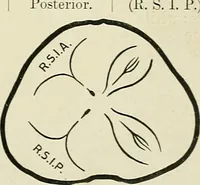 Picture 87 of 231 from Obstetrics : a text-book for the use of students and practitioners / by J. Whitridge Williams ... with eight coloured plates and six hundred and thirty illustrations in the text. (1903), leaf 225