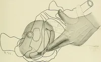 An illustration from Obstetrics : a text-book for the use of students and practitioners / by J. Whitridge Williams ... with eight coloured plates and six hundred and thirty illustrations in the text. (1903)