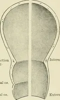 Picture 89 of 231 from Obstetrics : a text-book for the use of students and practitioners / by J. Whitridge Williams ... with eight coloured plates and six hundred and thirty illustrations in the text. (1903), leaf 253