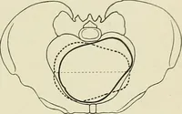 An illustration from Obstetrics : a text-book for the use of students and practitioners / by J. Whitridge Williams ... with eight coloured plates and six hundred and thirty illustrations in the text. (1903)
