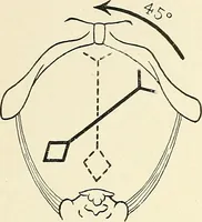 Picture 94 of 231 from Obstetrics : a text-book for the use of students and practitioners / by J. Whitridge Williams ... with eight coloured plates and six hundred and thirty illustrations in the text. (1903), leaf 280