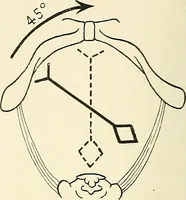 An illustration from Obstetrics : a text-book for the use of students and practitioners / by J. Whitridge Williams ... with eight coloured plates and six hundred and thirty illustrations in the text. (1903)