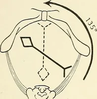 An illustration from Obstetrics : a text-book for the use of students and practitioners / by J. Whitridge Williams ... with eight coloured plates and six hundred and thirty illustrations in the text. (1903)
