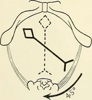 Picture 100 of 231 from Obstetrics : a text-book for the use of students and practitioners / by J. Whitridge Williams ... with eight coloured plates and six hundred and thirty illustrations in the text. (1903), leaf 288