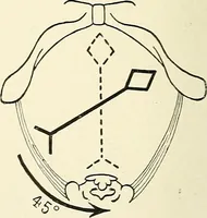 Picture 101 of 231 from Obstetrics : a text-book for the use of students and practitioners / by J. Whitridge Williams ... with eight coloured plates and six hundred and thirty illustrations in the text. (1903), leaf 288