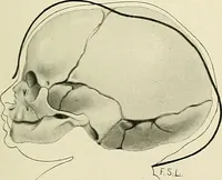 An illustration from Obstetrics : a text-book for the use of students and practitioners / by J. Whitridge Williams ... with eight coloured plates and six hundred and thirty illustrations in the text. (1903)