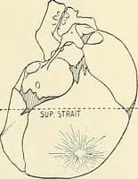 Picture 104 of 231 from Obstetrics : a text-book for the use of students and practitioners / by J. Whitridge Williams ... with eight coloured plates and six hundred and thirty illustrations in the text. (1903), leaf 302