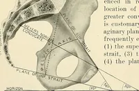 Picture 2 of 231 from Obstetrics : a text-book for the use of students and practitioners / by J. Whitridge Williams ... with eight coloured plates and six hundred and thirty illustrations in the text. (1903), leaf 32