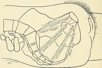 An illustration from Obstetrics : a text-book for the use of students and practitioners / by J. Whitridge Williams ... with eight coloured plates and six hundred and thirty illustrations in the text. (1903)