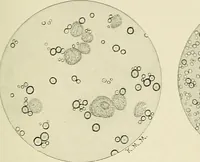 An illustration from Obstetrics : a text-book for the use of students and practitioners / by J. Whitridge Williams ... with eight coloured plates and six hundred and thirty illustrations in the text. (1903)