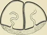 An illustration from Obstetrics : a text-book for the use of students and practitioners / by J. Whitridge Williams ... with eight coloured plates and six hundred and thirty illustrations in the text. (1903)
