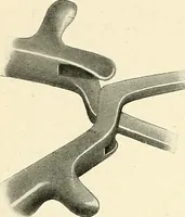 An illustration from Obstetrics : a text-book for the use of students and practitioners / by J. Whitridge Williams ... with eight coloured plates and six hundred and thirty illustrations in the text. (1903)