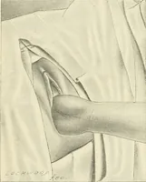 Picture 121 of 231 from Obstetrics : a text-book for the use of students and practitioners / by J. Whitridge Williams ... with eight coloured plates and six hundred and thirty illustrations in the text. (1903), leaf 418