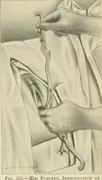 Picture 122 of 231 from Obstetrics : a text-book for the use of students and practitioners / by J. Whitridge Williams ... with eight coloured plates and six hundred and thirty illustrations in the text. (1903), leaf 419