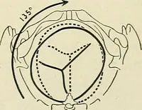 An illustration from Obstetrics : a text-book for the use of students and practitioners / by J. Whitridge Williams ... with eight coloured plates and six hundred and thirty illustrations in the text. (1903)