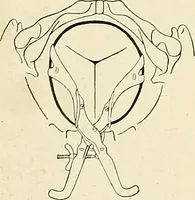 An illustration from Obstetrics : a text-book for the use of students and practitioners / by J. Whitridge Williams ... with eight coloured plates and six hundred and thirty illustrations in the text. (1903)