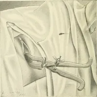 Picture 132 of 231 from Obstetrics : a text-book for the use of students and practitioners / by J. Whitridge Williams ... with eight coloured plates and six hundred and thirty illustrations in the text. (1903), leaf 424