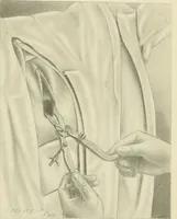 Picture 133 of 231 from Obstetrics : a text-book for the use of students and practitioners / by J. Whitridge Williams ... with eight coloured plates and six hundred and thirty illustrations in the text. (1903), leaf 425