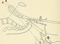 An illustration from Obstetrics : a text-book for the use of students and practitioners / by J. Whitridge Williams ... with eight coloured plates and six hundred and thirty illustrations in the text. (1903)