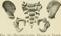 An illustration from Obstetrics : a text-book for the use of students and practitioners / by J. Whitridge Williams ... with eight coloured plates and six hundred and thirty illustrations in the text. (1903)
