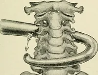 An illustration from Obstetrics : a text-book for the use of students and practitioners / by J. Whitridge Williams ... with eight coloured plates and six hundred and thirty illustrations in the text. (1903)