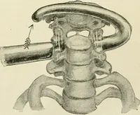 An illustration from Obstetrics : a text-book for the use of students and practitioners / by J. Whitridge Williams ... with eight coloured plates and six hundred and thirty illustrations in the text. (1903)